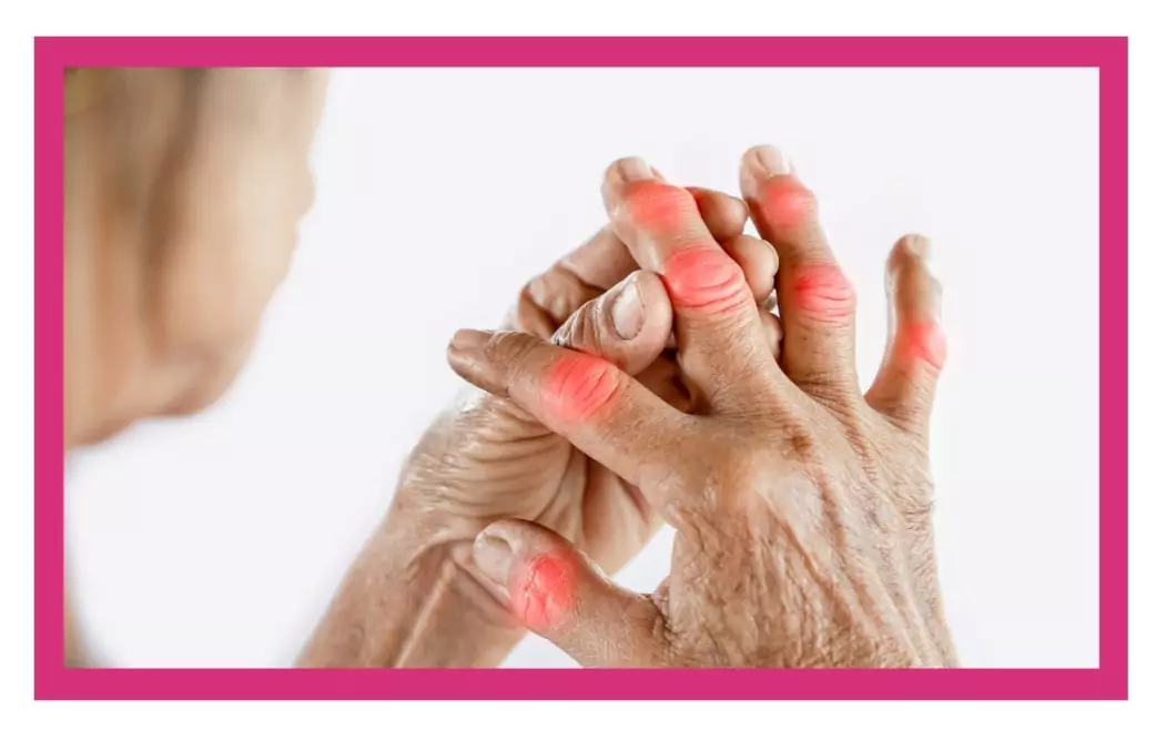 Arthritis Disorders
