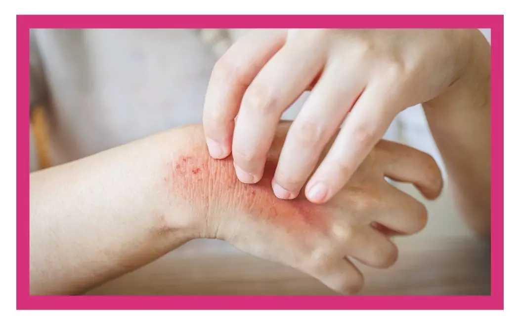 Fungal Infections