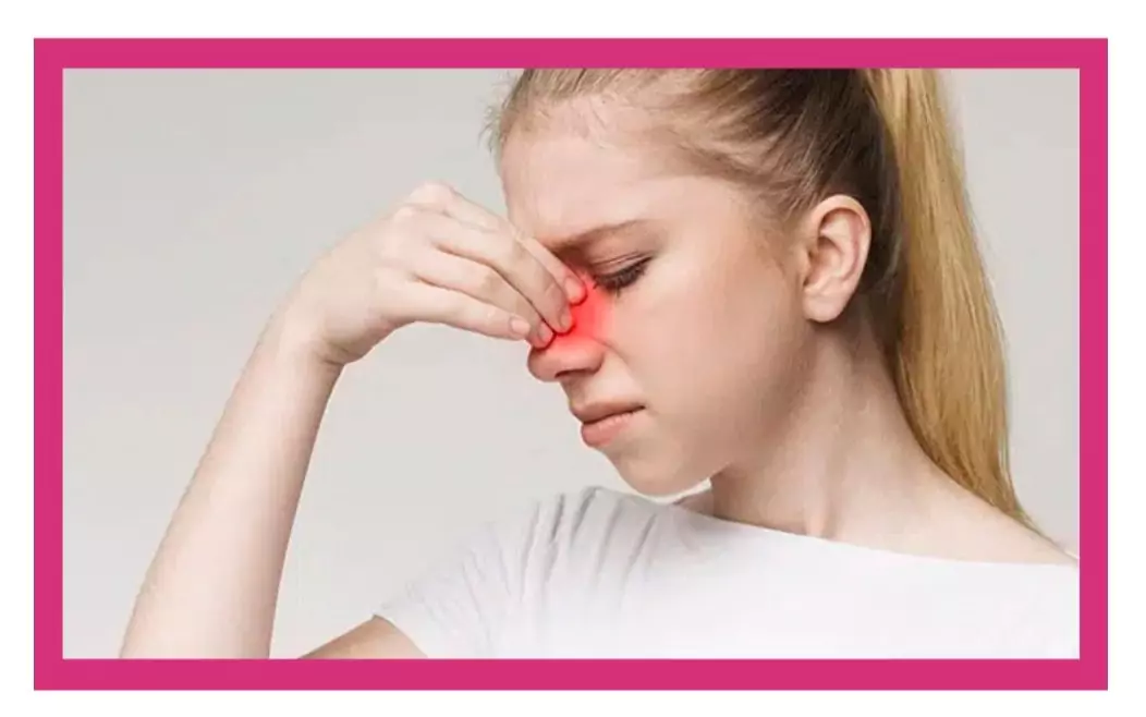 Nasal Polyps